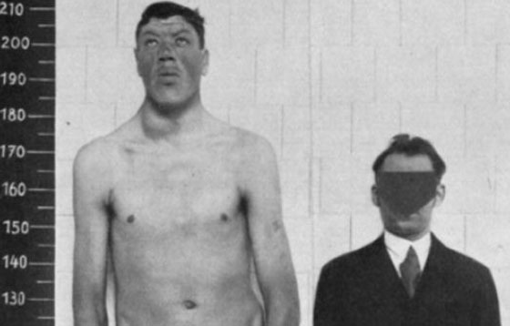 أغرب من الخيال.. رجل تحول من قزم إلى عملاق صورة رقم 4