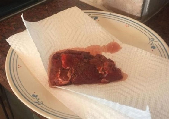 صور مقززة.. رجل يطهو قدمه المبتورة ويطعمها لاصدقائه! صورة رقم 2