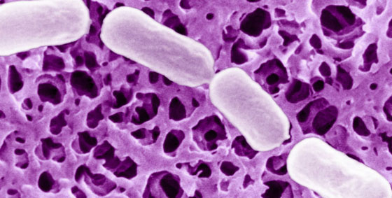 إليكم أشهر 10 سموم كيميائية فتاكة وقاتلة للإنسان! صورة رقم 7