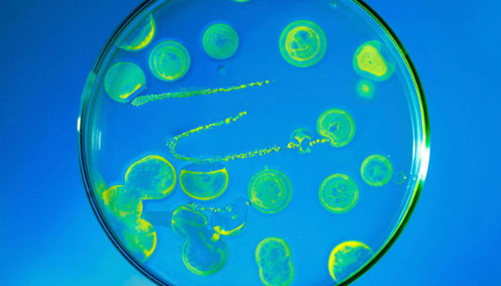 إليكم أشهر 10 سموم كيميائية فتاكة وقاتلة للإنسان! صورة رقم 8