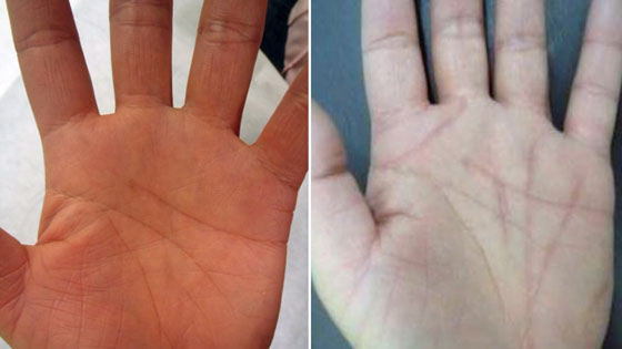 إليكم أغرب 10 عمليات تجميل في العالم صورة رقم 6
