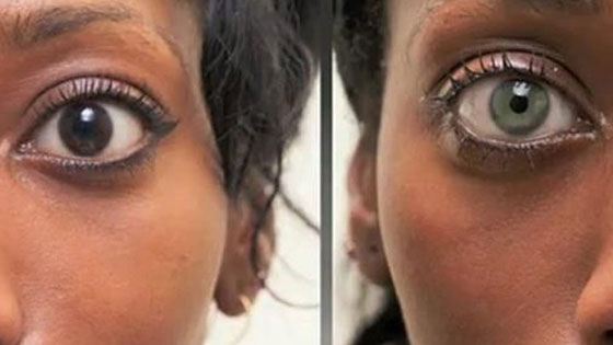 إليكم أغرب 10 عمليات تجميل في العالم صورة رقم 9
