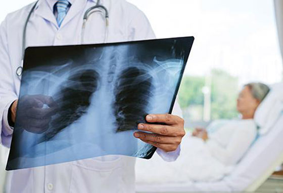 إذا تجاوزت سن الـ50.. احذر من هذه الأمراض والأوجاع صورة رقم 8
