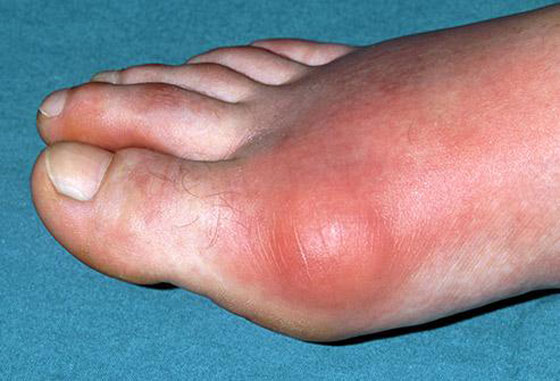 إذا تجاوزت سن الـ50.. احذر من هذه الأمراض والأوجاع صورة رقم 10