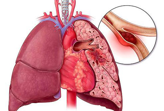 إذا تجاوزت سن الـ50.. احذر من هذه الأمراض والأوجاع صورة رقم 11