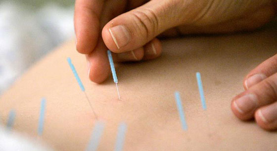 الضحك، الزهور والموسيقى.. للقضاء على المزاج السيء صورة رقم 5