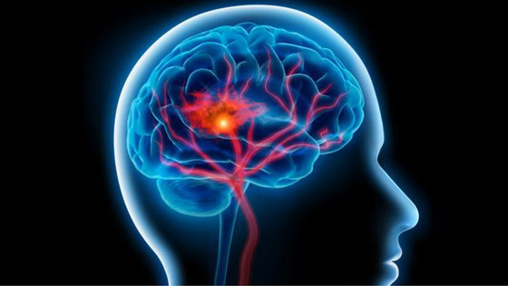 أكثر وأخطر مسببات للموت في العالم صورة رقم 2