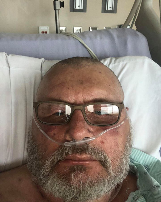 رجل أمريكي ينجو من الموت بأعجوبة بعد تعرضه لأكثر من 600 لدغة من النحل القاتل صورة رقم 4