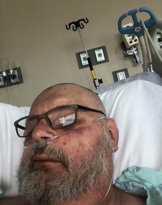 رجل أمريكي ينجو من الموت بأعجوبة بعد تعرضه لأكثر من 600 لدغة من النحل القاتل صورة رقم 5