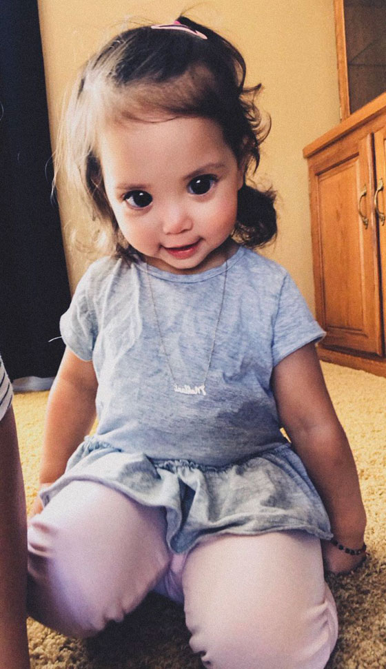 طفلة تعاني من مرض وراثي حوّلها الى احدى أميرات ديزني! صورة رقم 1 طفلة تعاني من مرض وراثي حوّلها الى احدى أميرات ديزني! صورة رقم 1