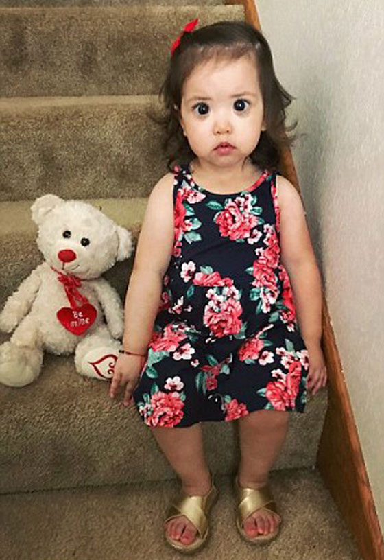 طفلة تعاني من مرض وراثي حوّلها الى احدى أميرات ديزني! صورة رقم 7 طفلة تعاني من مرض وراثي حوّلها الى احدى أميرات ديزني! صورة رقم 7