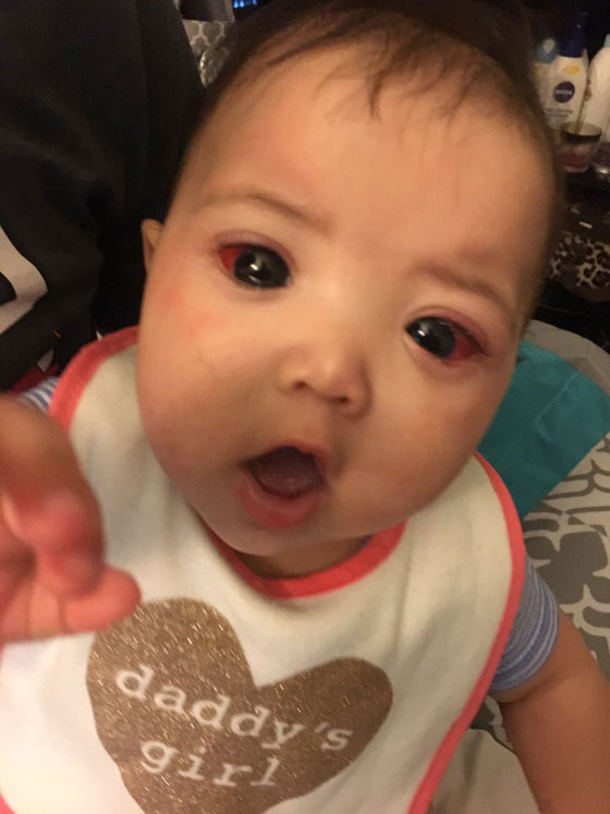 طفلة تعاني من مرض وراثي حوّلها الى احدى أميرات ديزني! صورة رقم 13 طفلة تعاني من مرض وراثي حوّلها الى احدى أميرات ديزني! صورة رقم 13