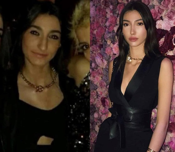 تهديد ملكة جمال تركيا بسحب اللقب بسبب  صور (قبل وبعد)! صورة رقم 2
