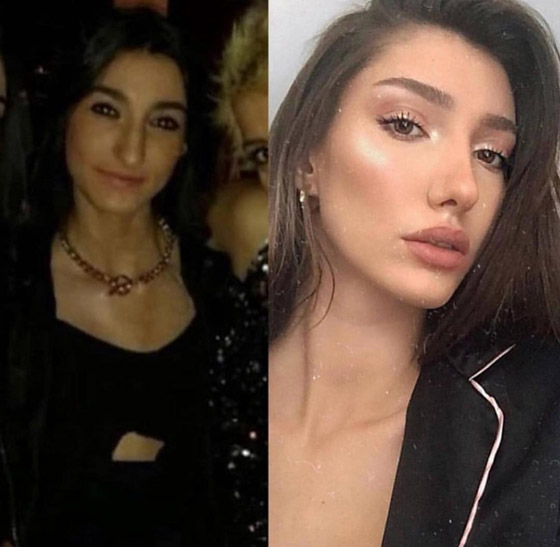 تهديد ملكة جمال تركيا بسحب اللقب بسبب  صور (قبل وبعد)! صورة رقم 4