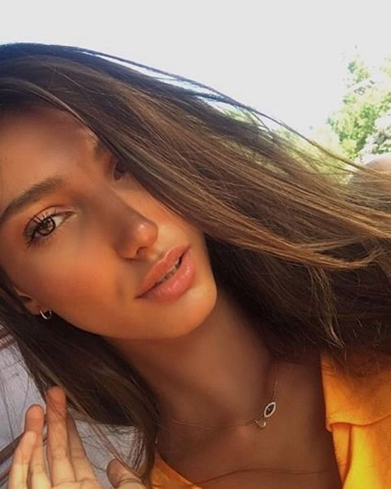 تهديد ملكة جمال تركيا بسحب اللقب بسبب  صور (قبل وبعد)! صورة رقم 9