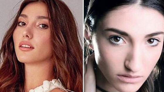 تهديد ملكة جمال تركيا بسحب اللقب بسبب  صور (قبل وبعد)! صورة رقم 10