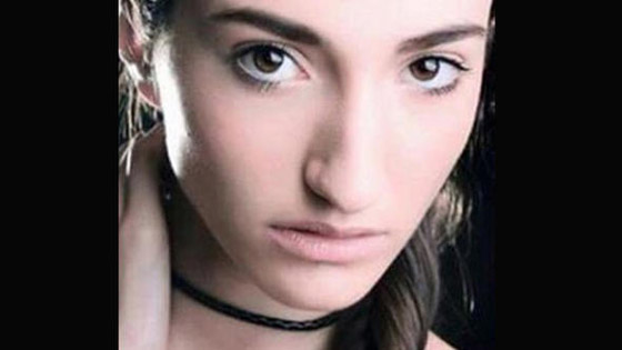 تهديد ملكة جمال تركيا بسحب اللقب بسبب  صور (قبل وبعد)! صورة رقم 11