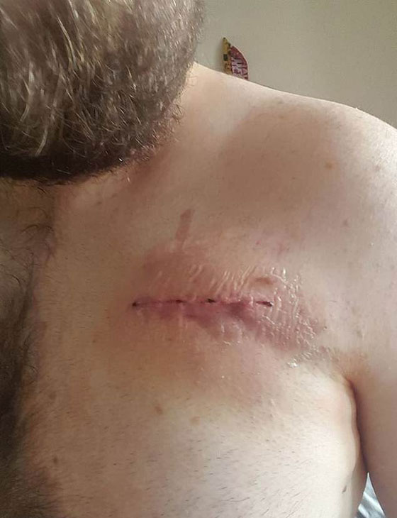 حالة غريبة..ما هي حكاية الرجل الذي مات 9 مرات؟ صورة رقم 2 حالة غريبة..ما هي حكاية الرجل الذي مات 9 مرات؟ صورة رقم 2