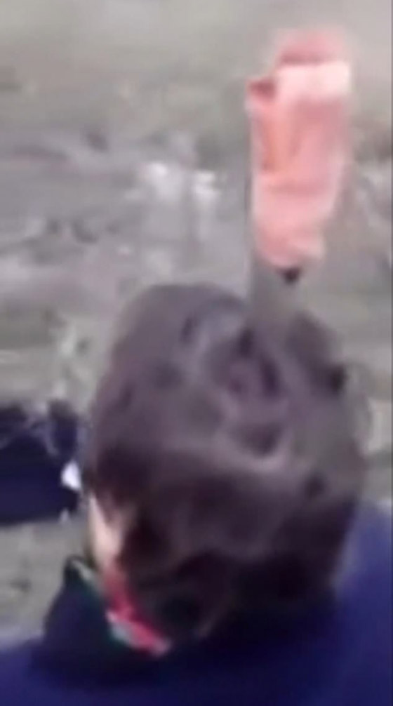 فيديو مروع.. رجل روسي غرس سكينا في رأسه لمساعدته على التنفس! صورة رقم 5 فيديو مروع.. رجل روسي غرس سكينا في رأسه لمساعدته على التنفس! صورة رقم 5
