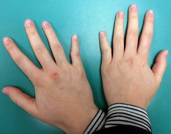 أمور غريبة قد ترثونها عن أهلكم عبر الجينات...!! صورة رقم 3