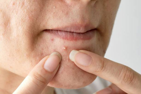 يمكنها تدمير الصحة.. إحذروا ممارسة هذه العادات بشكل مستمر  صورة رقم 2