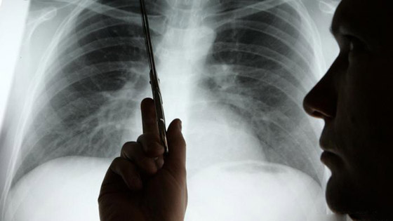  ���� ��� 7 - �� ���� �� �� ���� 10 ����� ������ �� ������