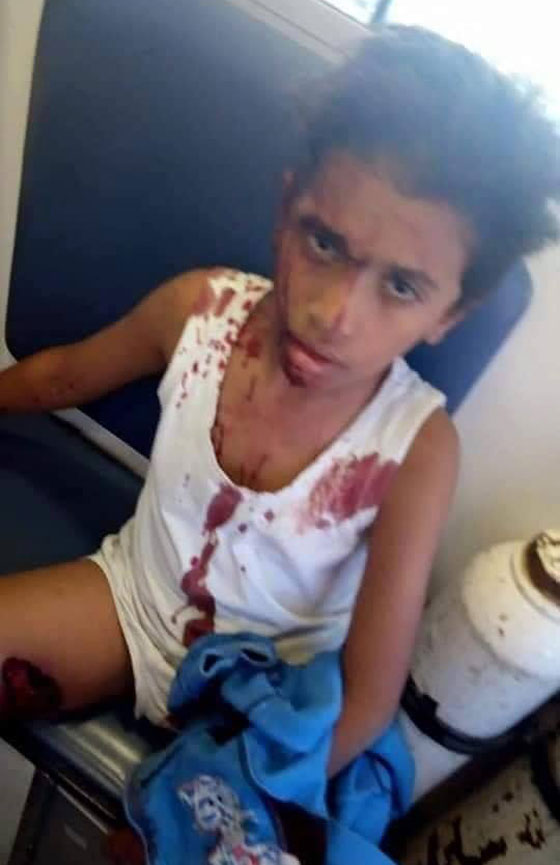 الصلاة على جثامين شهداء المنيا وطفل ناجي يروي ما فعله الارهابيون: فيديو صورة رقم 6 الصلاة على جثامين شهداء المنيا وطفل ناجي يروي ما فعله الارهابيون: فيديو صورة رقم 6