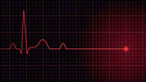 دراسة طبية مخيفة: الإنسان يكون واعي بعد موته ويسمع من حوله يتحدثون! صورة رقم 2