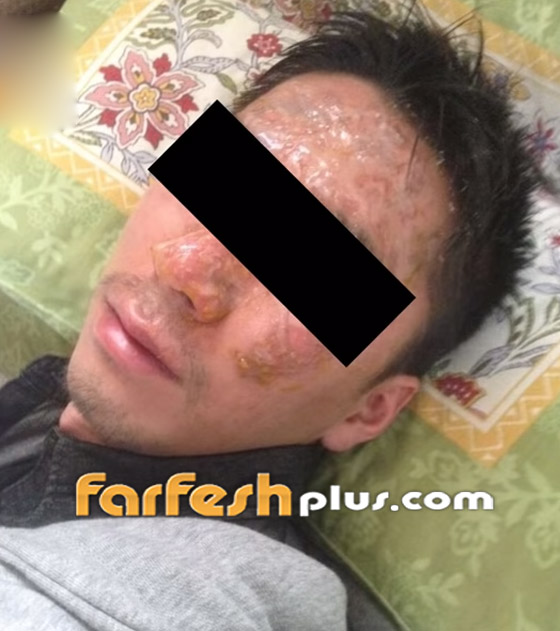 فيديو صادم.. رئيس شركة يابانية يضع وجه موظف داخل وعاء حساء مغلي صورة رقم 5 فيديو صادم.. رئيس شركة يابانية يضع وجه موظف داخل وعاء حساء مغلي صورة رقم 5