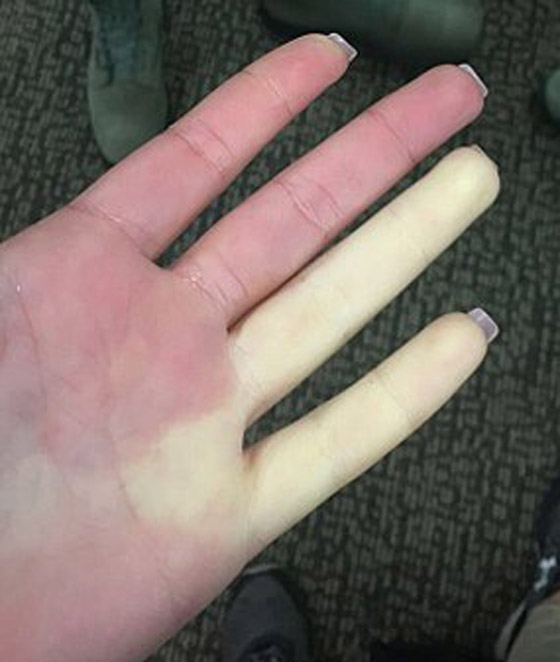 أشهر وأبرز أمراض الخريف والشتاء، وإليكم طرق الوقاية منها.. صورة رقم 7