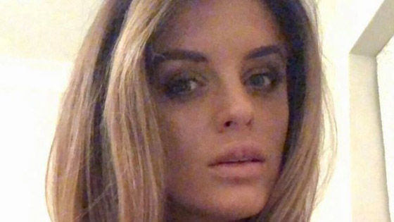صور صادمة: البوتوكس يحول سيدة بريطانية جميلة الى مسخ صورة رقم 4
