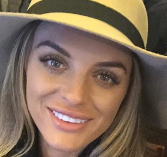 صور صادمة: البوتوكس يحول سيدة بريطانية جميلة الى مسخ صورة رقم 3