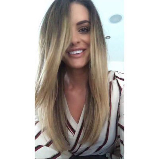صور صادمة: البوتوكس يحول سيدة بريطانية جميلة الى مسخ صورة رقم 9