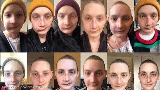 ناجية توثق بالصور رحلة شفائها من السرطان صورة رقم 2