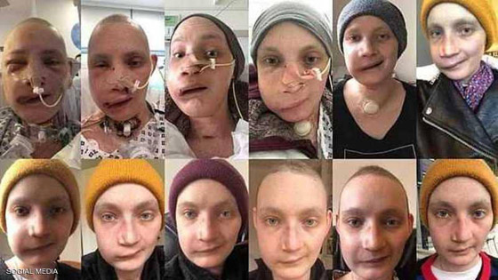 ناجية توثق بالصور رحلة شفائها من السرطان صورة رقم 1