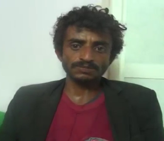  الطفل اليمني عقيل يموت جوعا أمام عيني والده! أين الضمير الانساني؟ صورة رقم 7