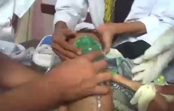  الطفل اليمني عقيل يموت جوعا أمام عيني والده! أين الضمير الانساني؟ صورة رقم 8