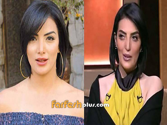  بالصور: نجمات عربيات اعترفن باجراء عمليات تجميل، وبعضهن ندمن! صورة رقم 1