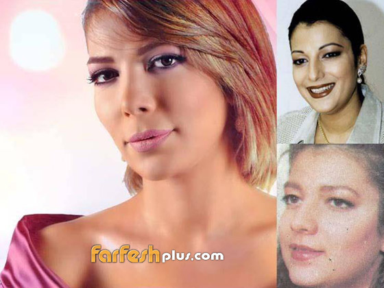  بالصور: نجمات عربيات اعترفن باجراء عمليات تجميل، وبعضهن ندمن! صورة رقم 6