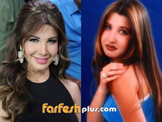  بالصور: نجمات عربيات اعترفن باجراء عمليات تجميل، وبعضهن ندمن! صورة رقم 7