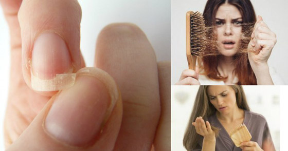 10 أعراض وعلامات تدل على نقص الفيتامينات يمكنك كشفها بسهولة صورة رقم 1 10 أعراض وعلامات تدل على نقص الفيتامينات يمكنك كشفها بسهولة صورة رقم 1