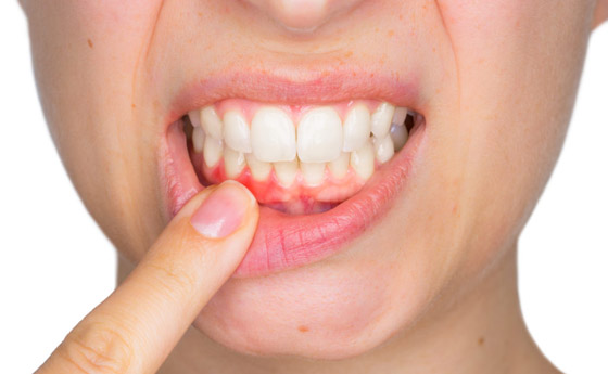 10 أعراض وعلامات تدل على نقص الفيتامينات يمكنك كشفها بسهولة صورة رقم 3 10 أعراض وعلامات تدل على نقص الفيتامينات يمكنك كشفها بسهولة صورة رقم 3