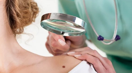 هذه الأعراض الـ 7 تتطلب زيارة طبيب أورام... صورة رقم 3