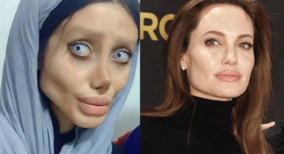 بالصور.. شاهدوا أغرب عمليات التجميل حول العالم صورة رقم 9