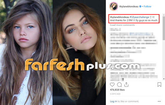 بالصور: أجمل فتاة في العالم تثير ضجة بتحدي العشر سنوات صورة رقم 1