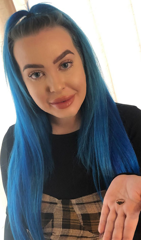 خبيرة تجميل بريطانية عطست فخرج خاتما من أنفها فقدته قبل 12 عاما! صورة رقم 1