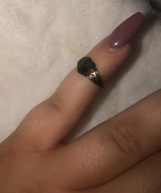 خبيرة تجميل بريطانية عطست فخرج خاتما من أنفها فقدته قبل 12 عاما! صورة رقم 2