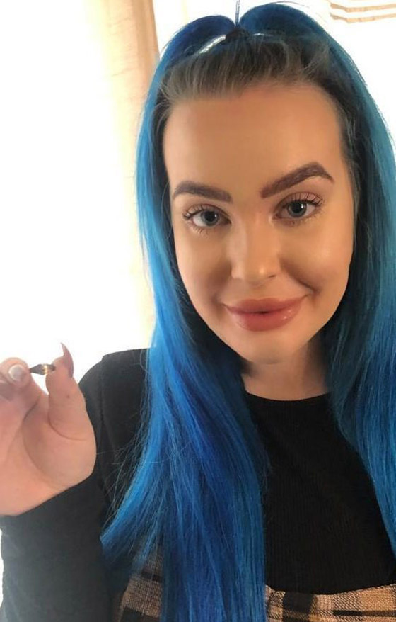 خبيرة تجميل بريطانية عطست فخرج خاتما من أنفها فقدته قبل 12 عاما! صورة رقم 6