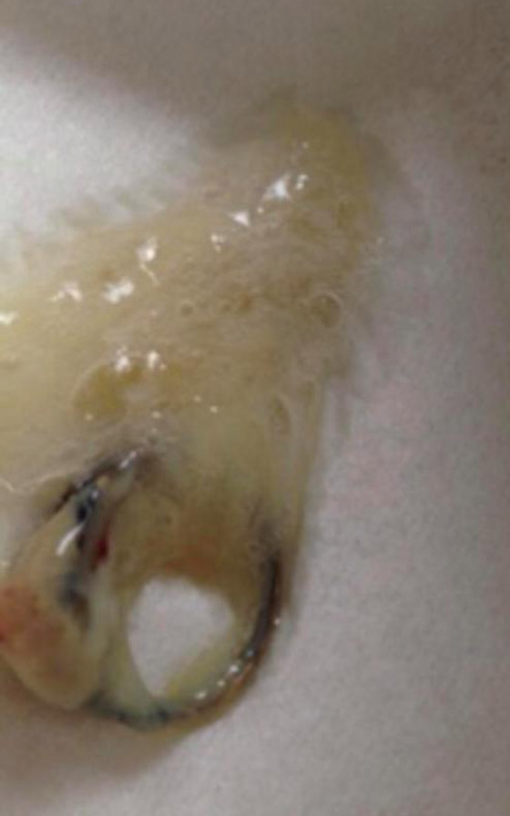 خبيرة تجميل بريطانية عطست فخرج خاتما من أنفها فقدته قبل 12 عاما! صورة رقم 8