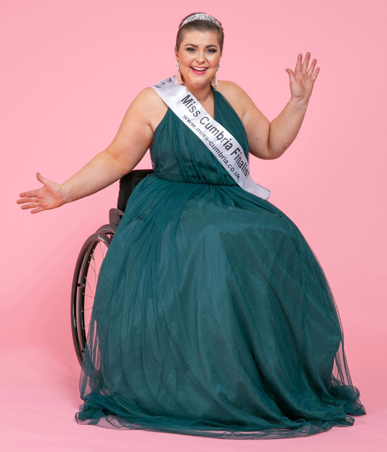 صورة رقم 1 - صور ملكة جمال على كرسي متحرك فازت بالتاج رغم الشلل ومرض السرطان! صورة رقم 1 - صور ملكة جمال على كرسي متحرك فازت بالتاج رغم الشلل ومرض السرطان!